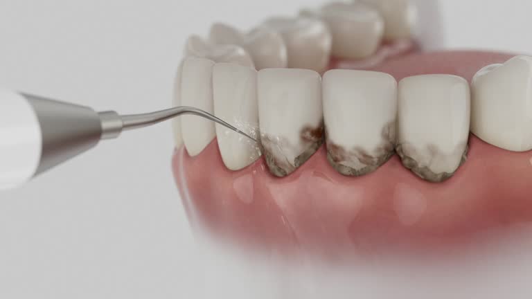 Reliable Dental Implants contractor in Putney, GA by Smile Center Dentistry